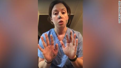 This nurse shows how quickly germs spread even if you wear gloves